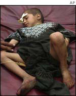 Victim of the attack