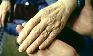 Arthritis patient