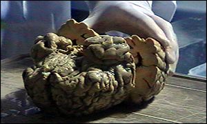 Brain