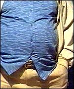 Obesity