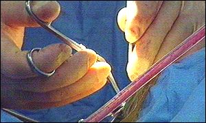 Surgery
