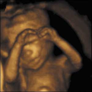 15 weeks gestation, 11cm crown to rump