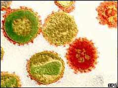 Aids virus