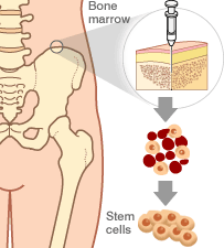 Adult stem cells
