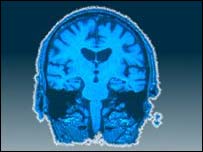 Radiografia do cérebro humano