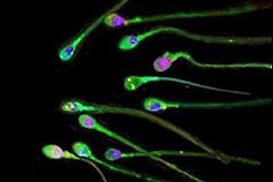 Sperm