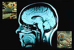 Birds such as the Zebra Finch can help unravel human memory