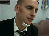 Injured reveller