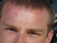 Leed's supporter with interesting sunburn...