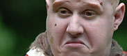 Matt Lucas as Toad