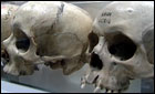 Skulls in the Hunterian Museum