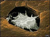 Célula óssea