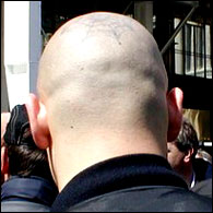 a skin head