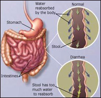 اسهال کودک 