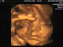 Scan of Clare and Steve's unborn baby