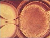 क्लोनिंग के लिए एक कोशिका के न्यूक्लियस को रिक्त अंडे में पहुँचाया जाता है