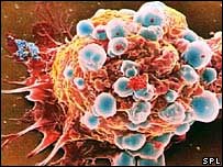 Tumor