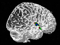 انسانی دماغ