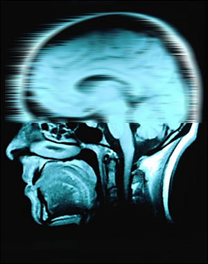 Cerebro humano con movimiento