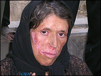 Gulbanú