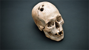 Ancient treatments for puzzling conditions