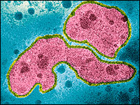 Avian flu virus type A, strain H5N1 c/o Science Photo Library
