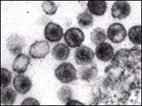 Virusi HIV