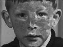 A dirty-faced David Edwards