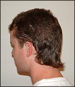 Mullet from the back.