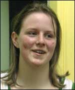 Becky with cuts and bruises