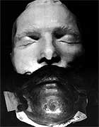 First World War photograph: gunner wearing prosthesis (image courtesy of the Wellcome Trust)