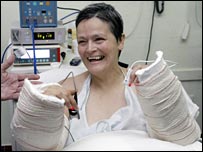 Alba, espanhola que passou por transplante de mão
