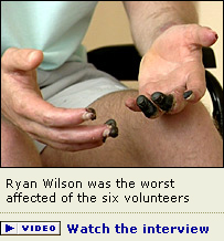 Ryan Wilson, one of the drug trial volunteers