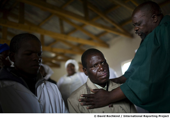 Tuberculosis in South Africa