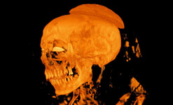 The Mummy X-ray