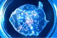 Laboratory image of the smallpox virus