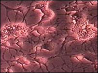 Neurônios