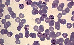 P. falciparum trophozoites