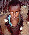 Starving Ethiopian child
