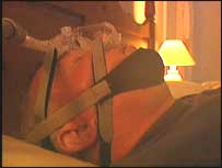 Post polio sufferer on ventilator