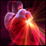 حملات قلبی