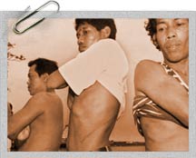 Kidney donors in the Philippines, AP