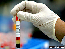 Blood test
