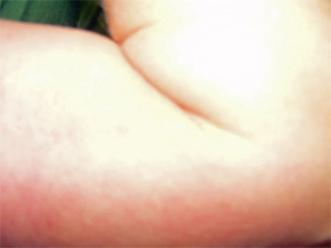 arm.jpg