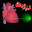 شکر و حملات قلبی