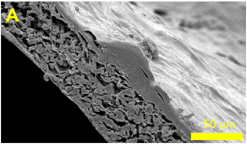 Skin cells growing on a polymer scaffold ...
