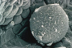 Egg in fallopian tube