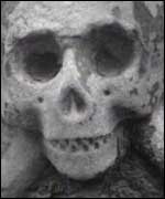 Skull and cross bones