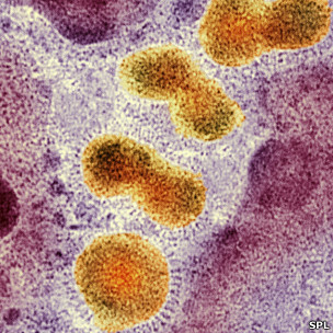 H5N1禽流感病毒