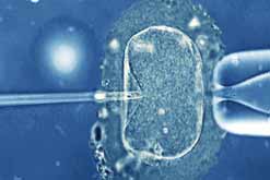 In-vitro fertilisation